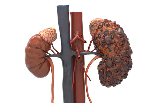 a computer generated image of a set of kidneys