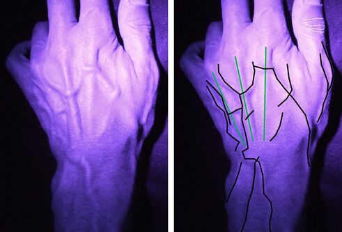 Pic showing identifying features in the hand