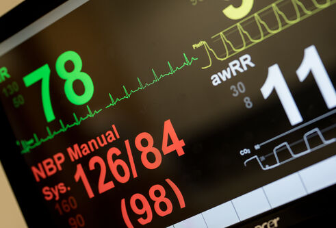 an image of a heart monitor displaying a heart rate of 78