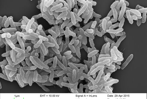P. aeruginosa bacteria