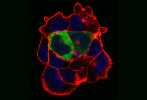 cells under microscope in red, green and blue