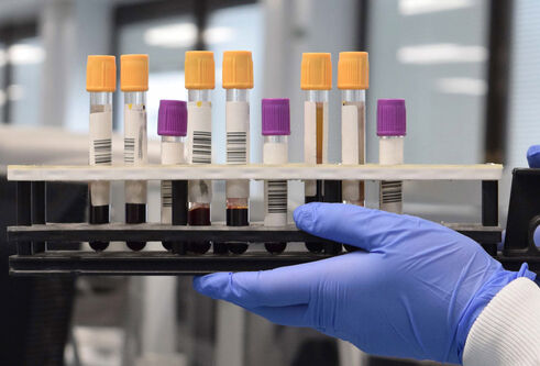 Researcher holding test tubes