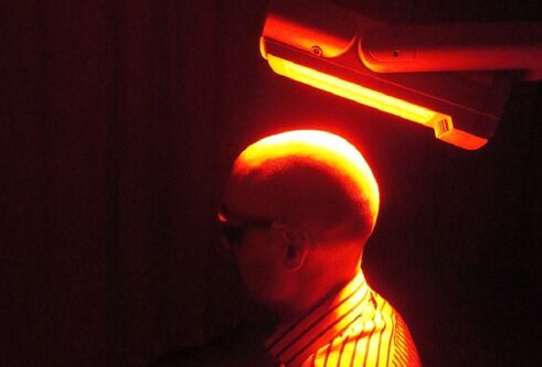 Person receiving Photodynamic therapy on their head