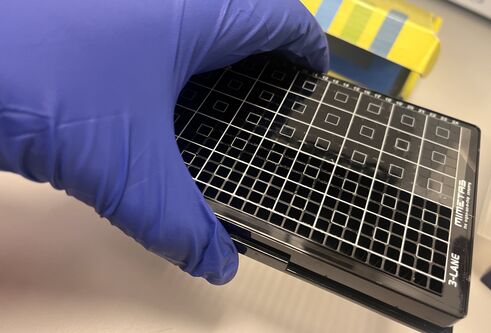 An example iPlacenta plate held in the hand of a Dundee researcher