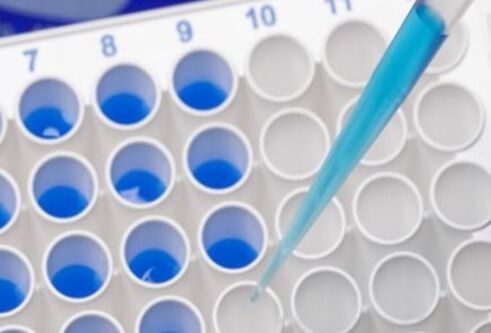 photograph of a partial image of 96 well plate with blue liquid in some of the wells. A pipette tip is seen above an empty well, the tip contains blue liquid.