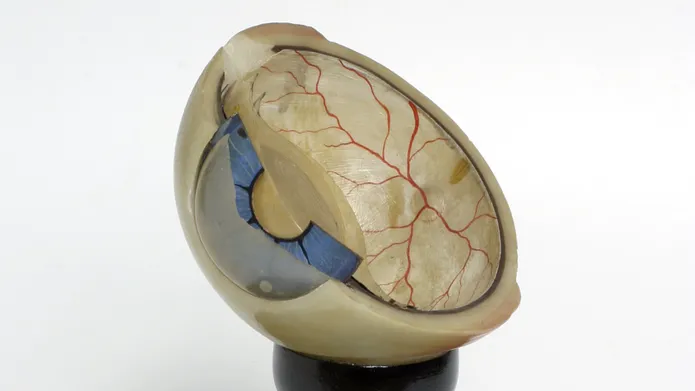 Model of eyeball