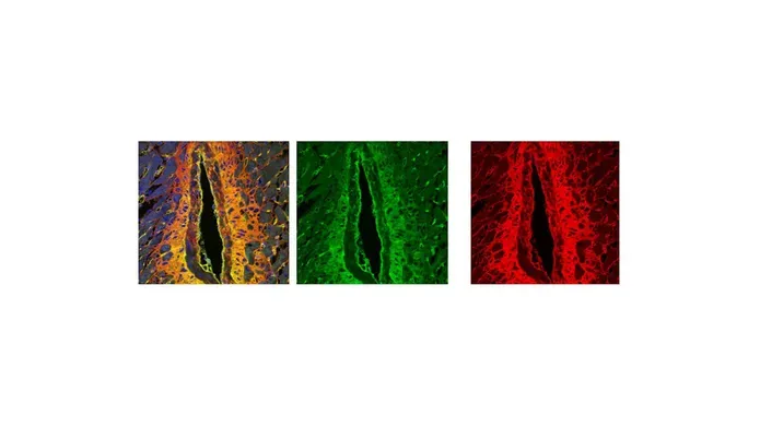 Three images in of vessels showing in a heart