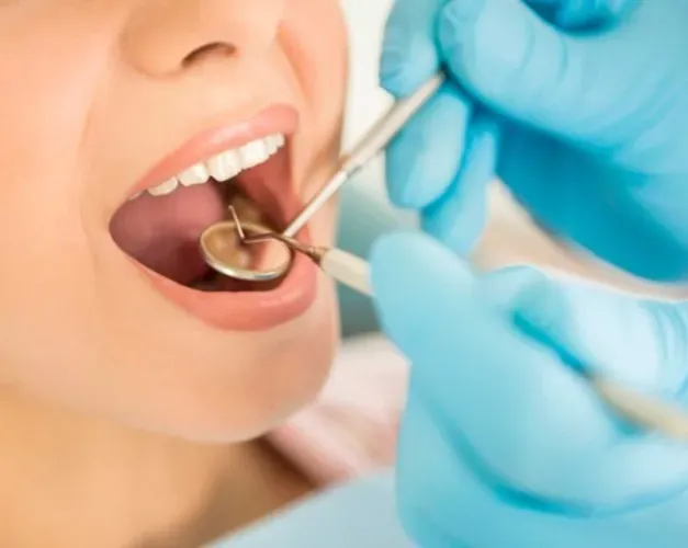 A person with their mouth open getting a dental check up