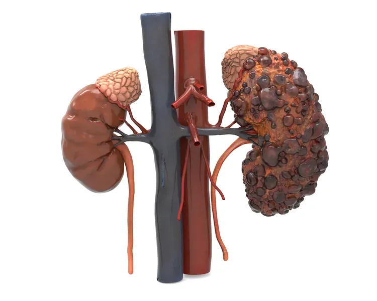 a computer generated image of a set of kidneys