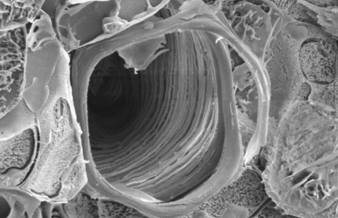 Photo of plant cell wall XylemSEM