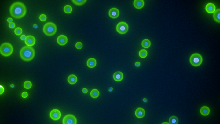 a black background with circular green glowing dots on it, which are actually fungal particles under a microscope